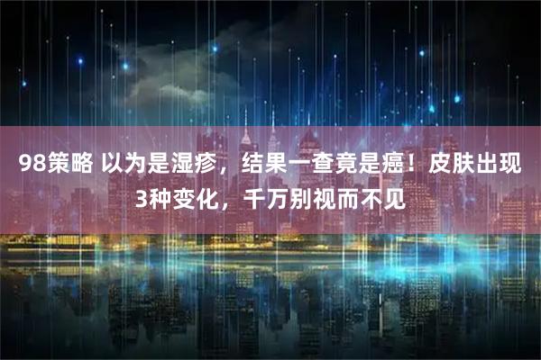98策略 以为是湿疹，结果一查竟是癌！皮肤出现3种变化，千万别视而不见